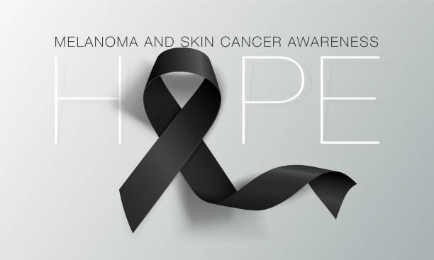 melanoma ve cilt kanseri farkındalık kaligrafi poster tasarım. umut. gerçekçi siyah şerit. mayıs kanser farkındalık ay olduğunu. vektör - istırap stock illustrations