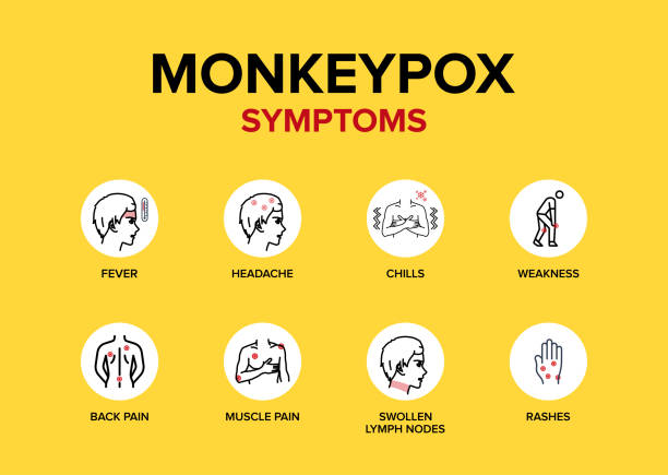 illustrazioni stock, clip art, cartoni animati e icone di tendenza di monkeypox disease sintomi icone vettoriali set banner o poster. - vaiolo delle scimmie