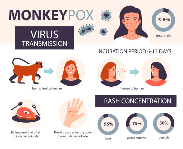 Monkeypox. Infection, symptoms, prevention of the disease of monkey pox. Flat vector illustration. Monkeypox. Infection, symptoms, prevention of the disease of monkey pox. Flat vector illustration. monkeypox vaccine stock illustrations