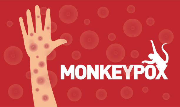 원숭이 두는원숭이 바이러스 감염으로 인한 드문 질병입니다. - monkey pox stock illustrations