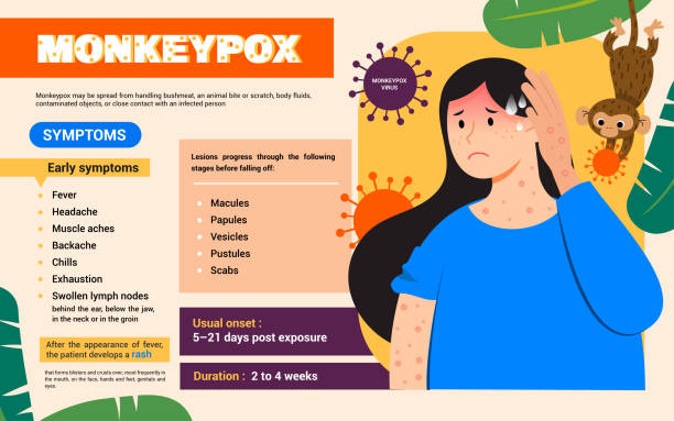ilustraciones, imágenes clip art, dibujos animados e iconos de stock de diseño vectorial de póster infográfico de síntomas de la viruela del mono - monkeypox vaccine