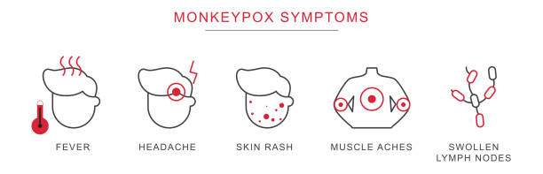 ilustraciones, imágenes clip art, dibujos animados e iconos de stock de los síntomas de la viruela del mono delinean el vector - monkeypox
