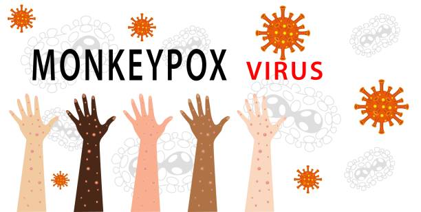 monkeypox virus illustration - 猴痘 幅插畫檔、美工圖案、卡通及圖標