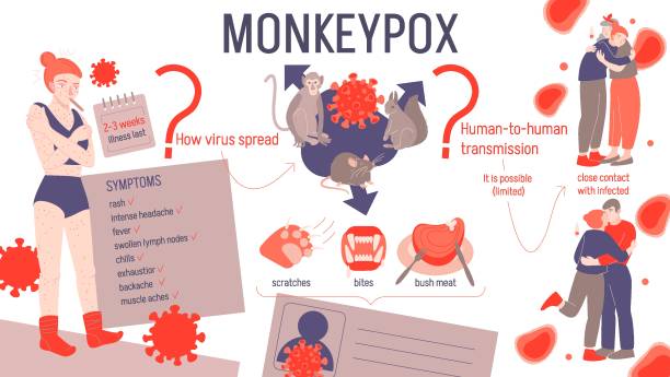 monkeypox virus infographics. landscape poster, informative medical banner. - 痘類病毒 幅插畫檔、美工圖案、卡通及圖標