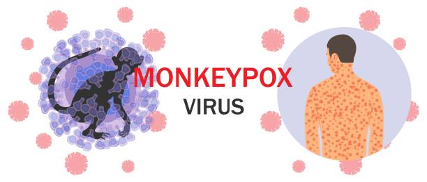 ilustrações de stock, clip art, desenhos animados e ícones de monkeypox virus, monkey, text,human body with rash - varíola