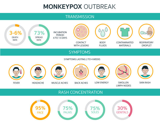monkeypox virus outbreak detailed infographics world health organization. symptoms, transmission, rash concentration, rate. infected people spreading from monkey. flat design with icons - 猴痘 幅插畫檔、美工圖案、卡通及圖標