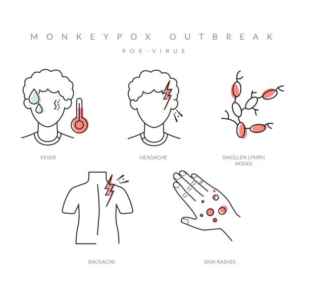 illustrazioni stock, clip art, cartoni animati e icone di tendenza di monkeypox - sintomi del virus - icona - vaiolo delle scimmie