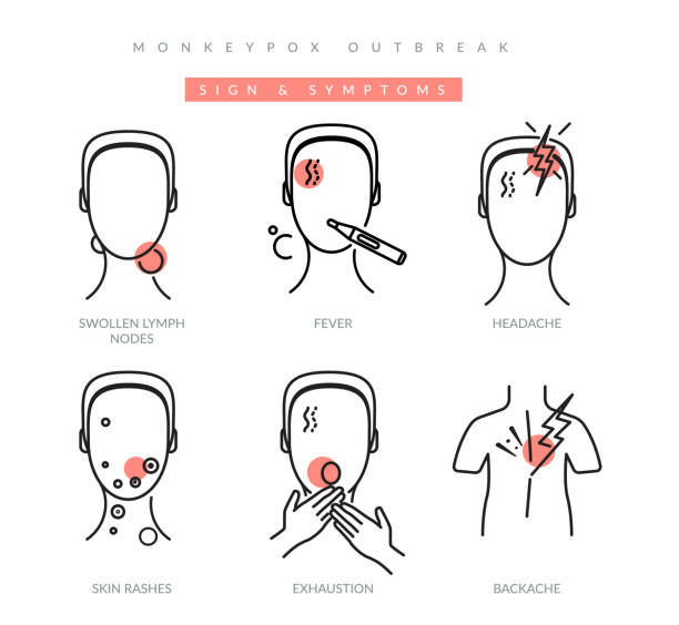 illustrations, cliparts, dessins animés et icônes de variole du singe - symptômes du virus - icône - monkeypox