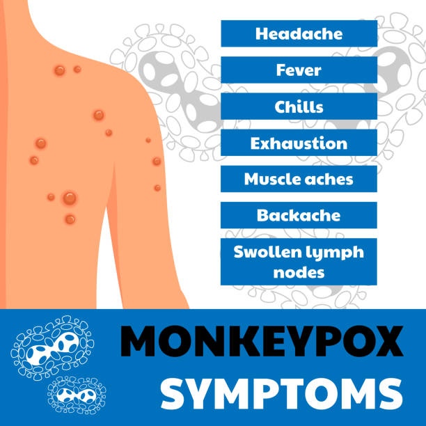 monkeypox virus symptoms. web banner of monkey pox skin infection of person. used for awareness people. vector illustration. - 猴痘 幅插畫檔、美工圖案、卡通及圖標