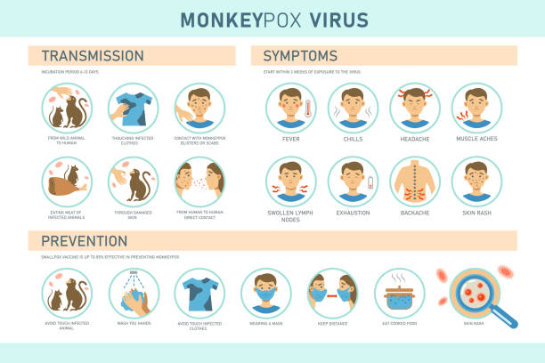monkeypox virus transmission, symptoms and prevention infographics with icons. - 痘類病毒 幅插畫檔、美工圖案、卡通及圖標