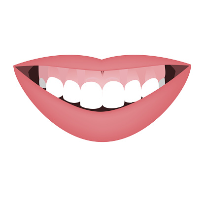 Mouth with a distal bite and high smile line or gummy smile before the orthotropics or orthotropics treatment. Vector illustration