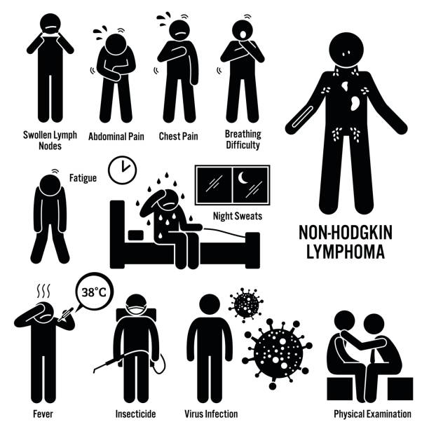 Non-Hodgkin Lymphoma Lymphatic Cancer Symptoms Causes Risk Factors Diagnosis Stick Figure Pictogram Icons Set of illustrations for Non-Hodgkin lymphoma lymphatic cancer disease which include the symptoms, causes, risk factors, and the diagnosis for the illness. exhaustion stock illustrations