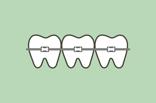 Download Orthodontic Teeth Or Dental Braces Stock Illustration ...