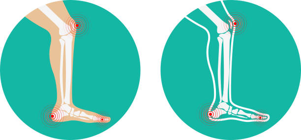 Pain in legs. knee pain, heel pain. Pain in legs. knee pain, heel pain. Vector illustration. human knee stock illustrations