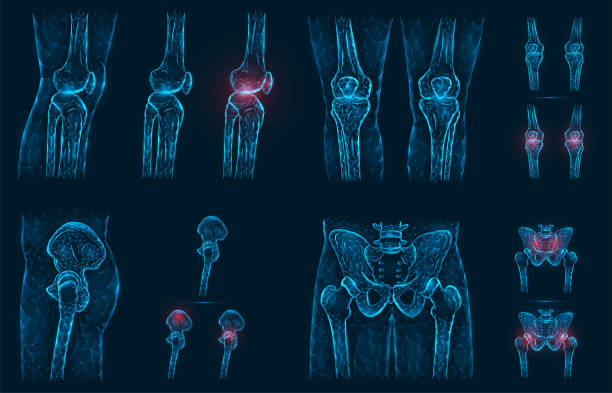 Pain, injury or inflammation in the knees and pelvis polygonal vector illustration. Low poly model of a sore knee, hip and hip joint. Pain, injury or inflammation in the knees and pelvis polygonal vector illustration. Low poly model of a sore knee, hip and hip joint. pain backgrounds stock illustrations