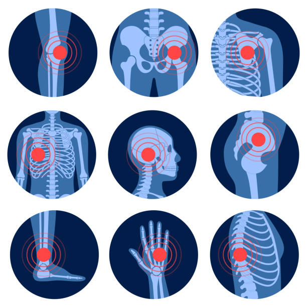 Pain4_Skeleton Human man skeleton pain, fracture or inflammation, parts of male body on x ray view. Vector isolated flat illustration of skull and bones on reontgen. Medical, educational or science banner. pain icons stock illustrations