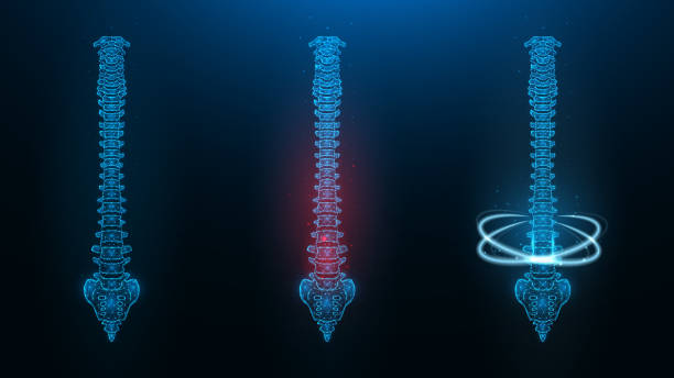 Polygonal vector illustration of a human spine. Image of a healthy, sick and recovering spine. Polygonal vector illustration of a human spine. Image of a healthy, sick and recovering spine. pain backgrounds stock illustrations