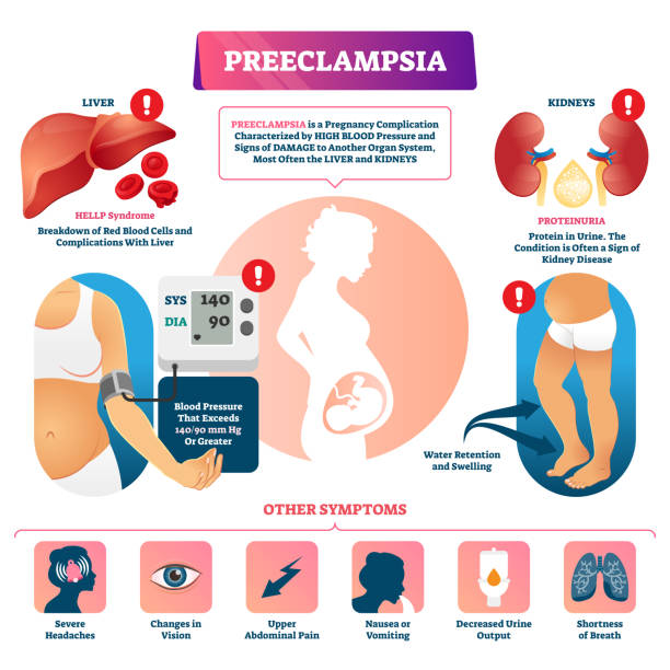 Preeclampsia can cause blurred vision