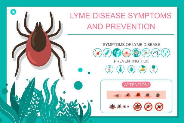 Preventing tick bite and lyme disease symptoms. Vector cartoon medical infographic. Preventing tick bite and lyme disease vector illustration. lyme disease stock illustrations