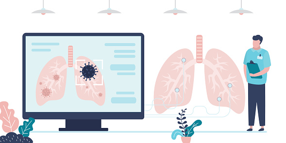 Pulmonologist examines respiratory organ. Detecting coronavirus using equipment. Affected lungs on computer screen. Concept of healthcare, diseases and covid-19. Trendy flat vector illustration