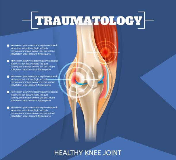 реалистичная иллюстрация травматологии медицины в 3d - конечность часть тела stock illustrations
