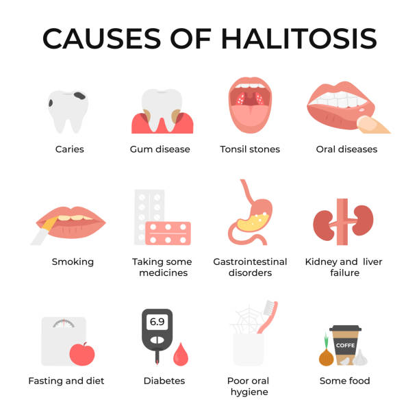 set causes of halitosis icons Set icons causes of halitosis, Bad breath, unpleasant breath odor. Flat vector illustration. bad breath stock illustrations