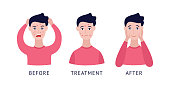Set of man with acne before and after treatment cartoon flat style, vector illustration isolated on white background. Steps of male problem pimply skin treatment and care