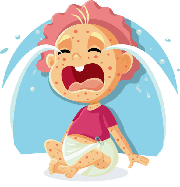 生病哭泣的嬰兒與麻疹插圖 - 天花病毒 幅插畫檔、美工圖案、卡通及圖標
