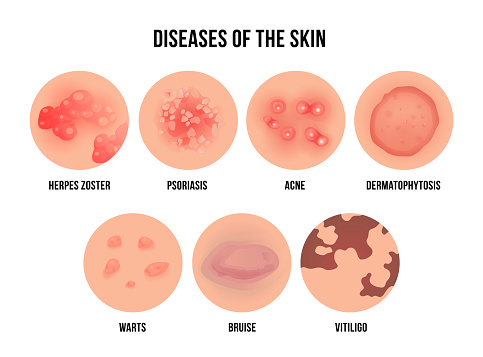 Skin Disease Types Of Dermatology Problems With Names ...