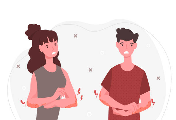 Skin problems concept Skin problems concept. Man and girl have itchy hands. Illness, embarrassment. Characters have allergies, eczema, acne, dermatic. Cartoon flat vector illustration isolated on white background allergy medicine stock illustrations