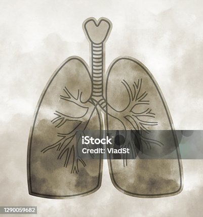 istock Smoking Lungs Cancer Asthma Airways Pneumonia Respirator Concept Illustration 1290059682