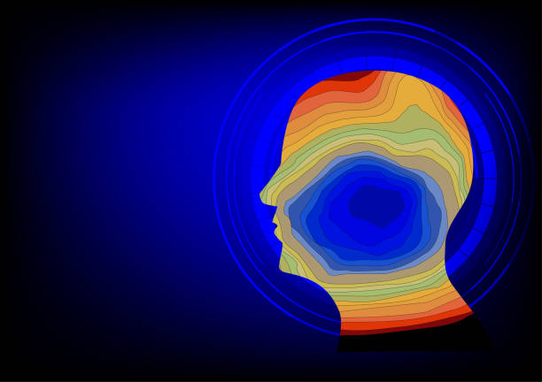 Source imaging of human epileptic focus vector art illustration
