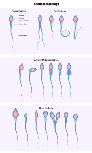 Sperm morphology, Semen analysis