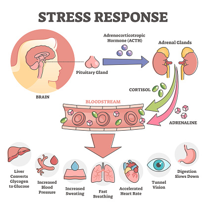 Stress response anatomical scheme with body inner reaction outline concept. Hormonal process with symptoms and description when ACTH, cortisol and adrenaline flows in bloodstream vector illustration.