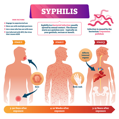 Syphilis vector illustration. Labeled sexual infection explanation scheme.