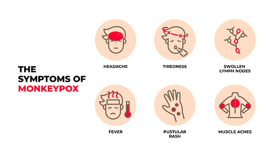 The symptoms of Monkeypox virus infographic vector.