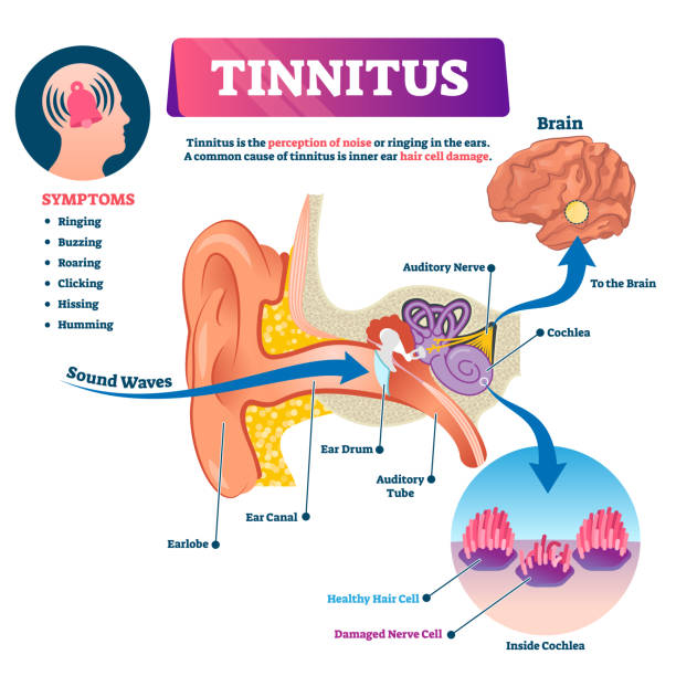 ilustraciones, imágenes clip art, dibujos animados e iconos de stock de ilustración vectorial de tinnitus. etiquetado tejas ruido percepción problema de oído - oreja humana