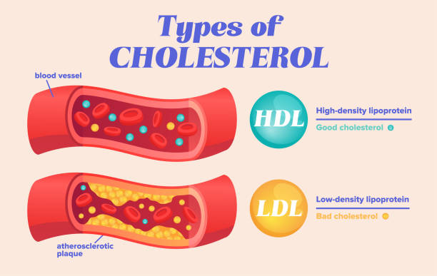 Types of cholesterol comparison with HDL and LDL Types of cholesterol comparison with HDL and LDL lipoprotein. Labeled educational normal and narrowed artery cross section explanation. Physiological high fat diet problem example. Vector illustration blood vessel stock illustrations