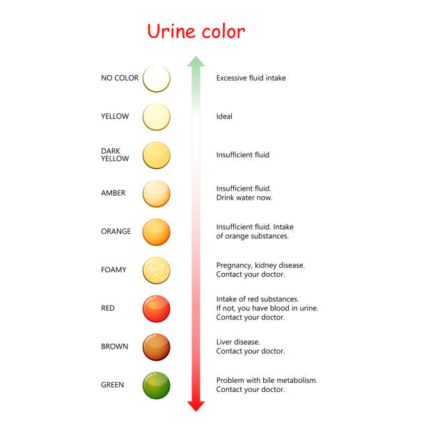 urine color chart for assessing hydration and dehydration vector id1186877930?k=20&m=1186877930&s=612x612&w=0&h=OMXZmSuQKnGKc3y