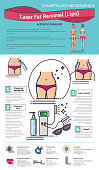 Vector Illustrated set with Laser LIPO Fat Removal. Infographics with icons of medical cosmetic procedures for body.