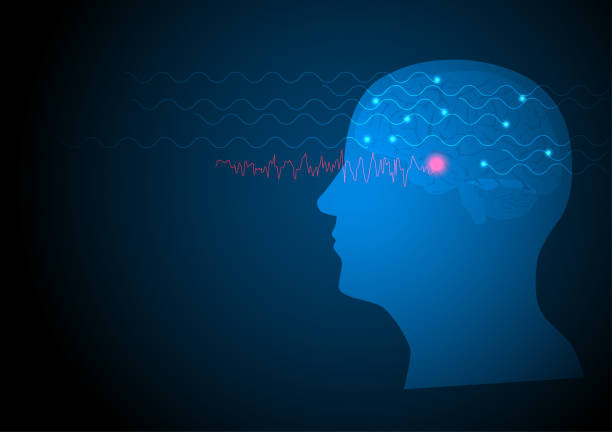 Vector illustration of human EEG seizure from temporal lobe vector art illustration