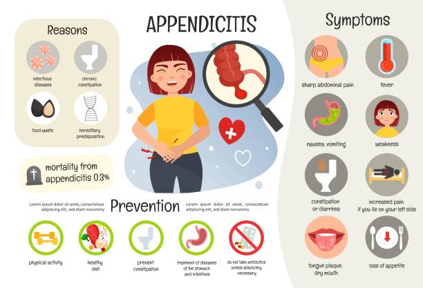 Vector medical poster appendicitis. vector art illustration