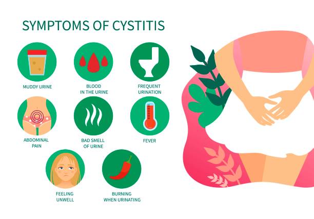 Vector medical poster symptoms of cystitis. vector art illustration