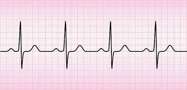 ECG wave ECG wave on printout paper. electrocardiography stock illustrations