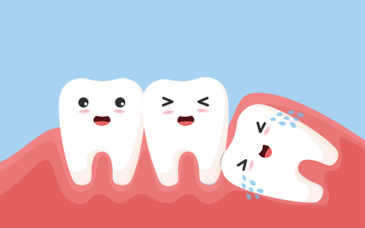 Wisdom tooth push other tooth Concept.