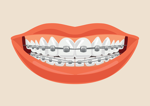 Download Woman Smile With Braces Vector Flat Cartoon Illustration ...