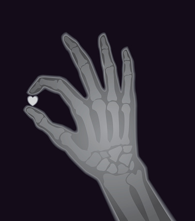 X-ray Image Human Hand Holding Heart Shape