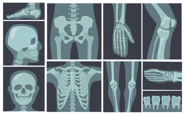 X-ray shots of human body X-ray shots of human body. Cartoon vector illustration. X-rays of pelvis, chest, knees, feet in black background. Skeleton, X-ray, bone roentgen, medicine, health, research concept for banner design human joint stock illustrations